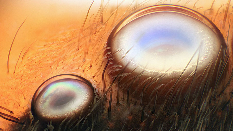 Illustration for article titled Seeing the Scary Wondrous World in These Micro Photos Will Give You Beautiful Nightmares